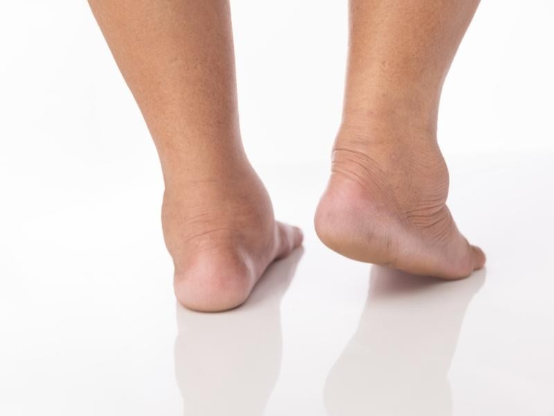 💧 Anidro X (Carboxiterapia) e Circulação: Redução de Inchaço e Retenção de Líquidos