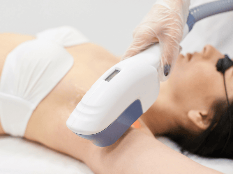 Qual o valor da depilação a laser? Saiba o que realmente influencia no preço e por que a Clínica Magrass oferece o melhor custo-benefício da região