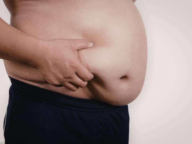 👨‍⚕️🔥 Termolipo Masculina (Termoterapia): Como Funciona, Benefícios e Por Que Homens Estão Procurando Esse Tratamento