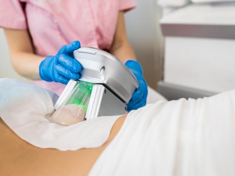 🧊 Criolipólise Masculina: Gordura Localizada Tem Solução