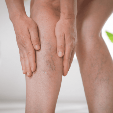 Tratamento para Microvasos - PEIM em Camaquã