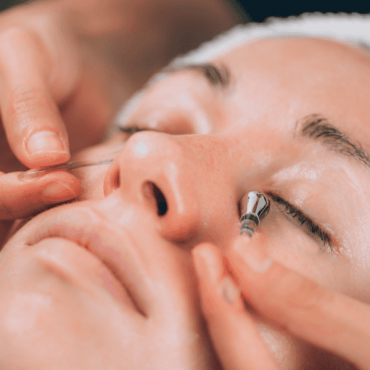 Tratamento para Olheiras em Camaquã