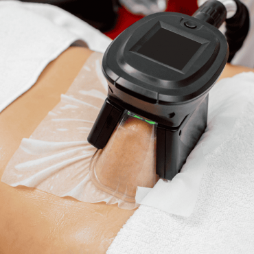 Tratamento para Gordura Localizada em Camaquã