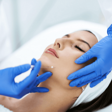 Fios de Sustentação em Camaquã