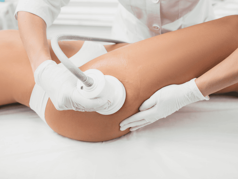 Tratamento para Celulite