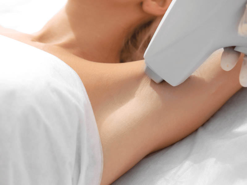 Depilação a Laser Feminina