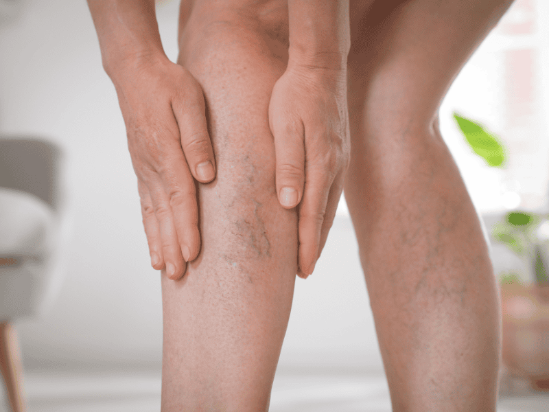 Tratamento para Microvasos - PEIM