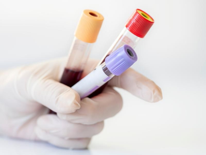 Teste Nutrigenético