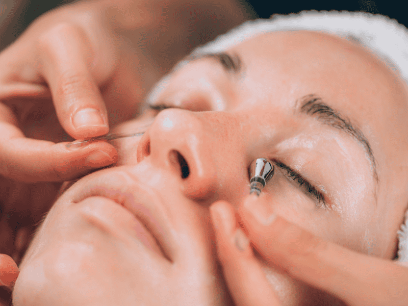 Tratamento para Olheiras