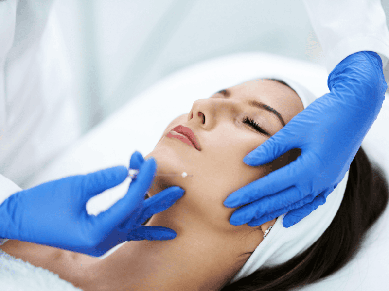 Fios de Sustentação